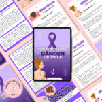 Estudos de caso - Câncer de Pele